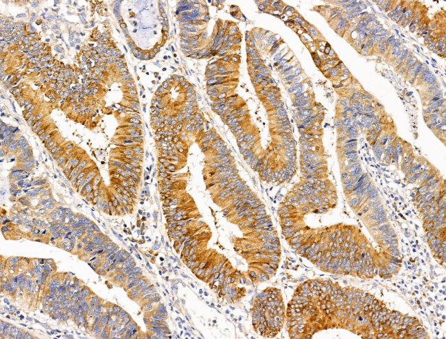 SULF1 Antibody in Immunohistochemistry (Paraffin) (IHC (P))