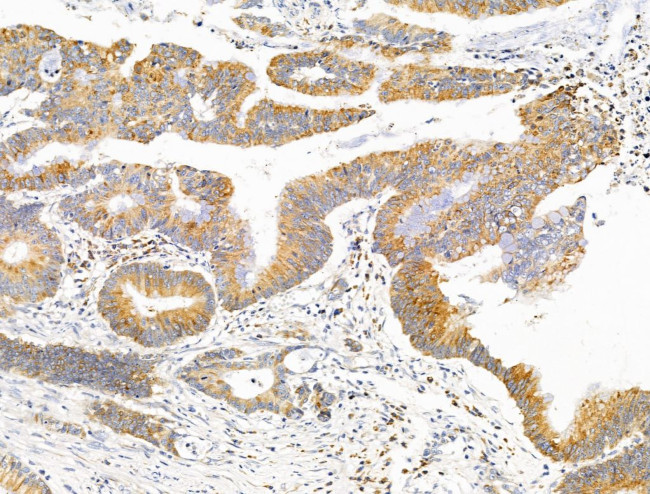 SULF1 Antibody in Immunohistochemistry (Paraffin) (IHC (P))