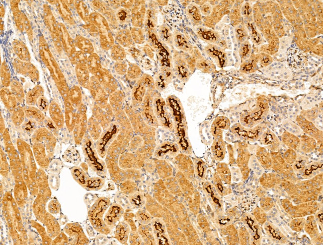 SULF1 Antibody in Immunohistochemistry (Paraffin) (IHC (P))