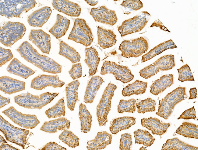 SULF1 Antibody in Immunohistochemistry (Paraffin) (IHC (P))