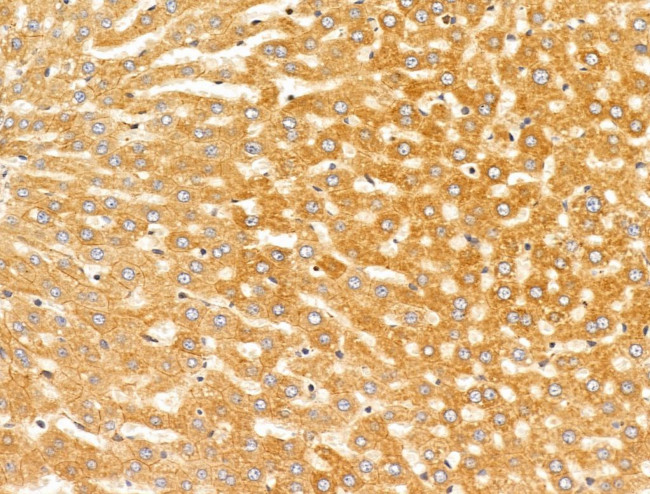 SULF1 Antibody in Immunohistochemistry (Paraffin) (IHC (P))