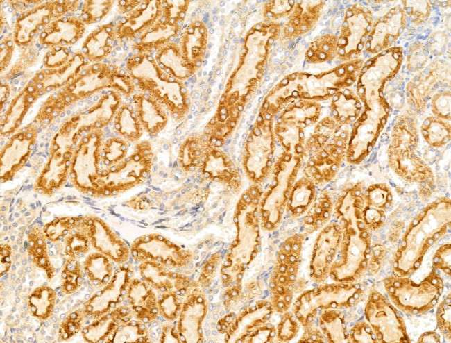 SULF1 Antibody in Immunohistochemistry (Paraffin) (IHC (P))