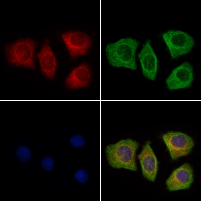 SFTPA2 Antibody in Immunocytochemistry (ICC/IF)