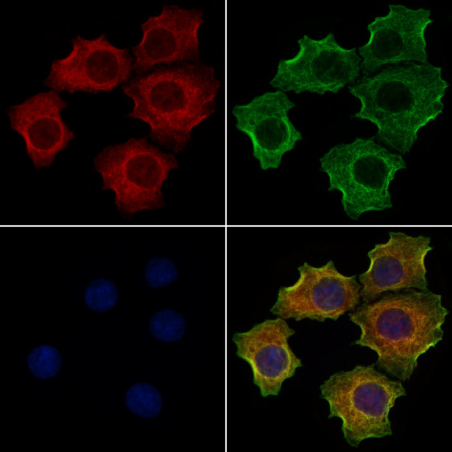 SFTPD Antibody in Immunocytochemistry (ICC/IF)