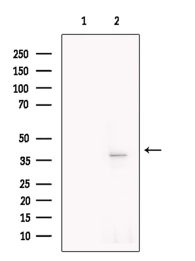 SFTPD Antibody in Western Blot (WB)