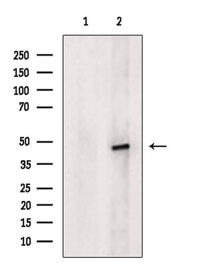 SUV39H1 Antibody in Western Blot (WB)