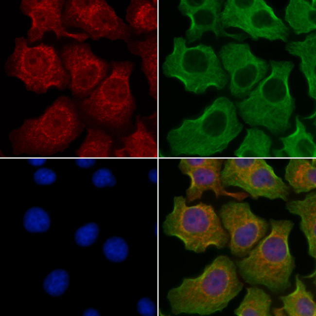 Synaptojanin 1 Antibody in Immunocytochemistry (ICC/IF)