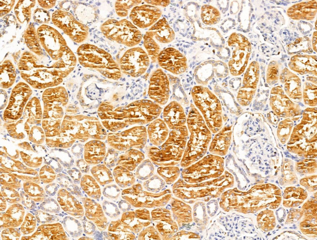 Synaptojanin 1 Antibody in Immunohistochemistry (Paraffin) (IHC (P))