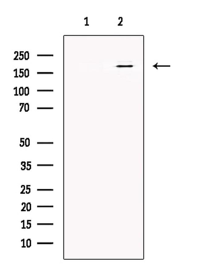 Synaptojanin 1 Antibody in Western Blot (WB)