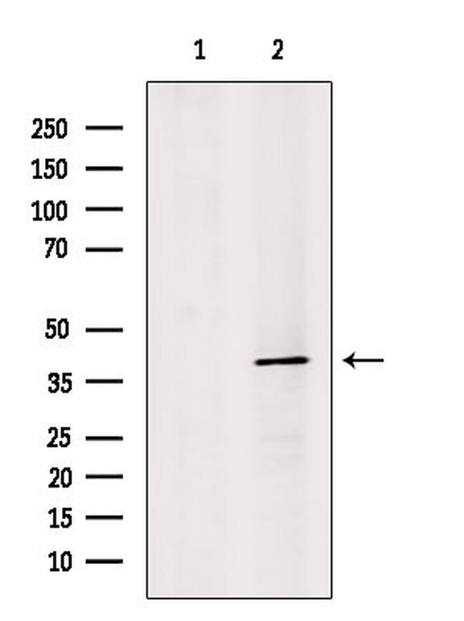 Synaptotagmin 5 Antibody in Western Blot (WB)