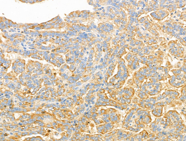 Syntaxin 2 Antibody in Immunohistochemistry (Paraffin) (IHC (P))