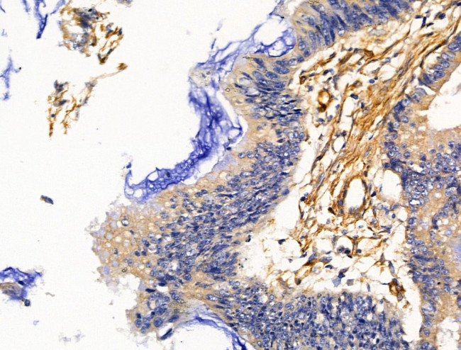 PLS3 Antibody in Immunohistochemistry (Paraffin) (IHC (P))