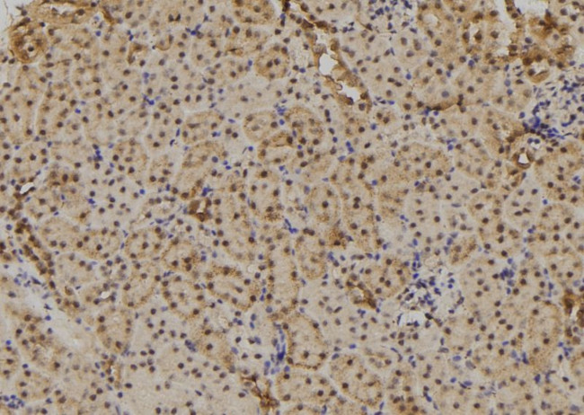 TAB1 Antibody in Immunohistochemistry (Paraffin) (IHC (P))