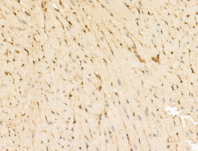 TACC2 Antibody in Immunohistochemistry (Paraffin) (IHC (P))