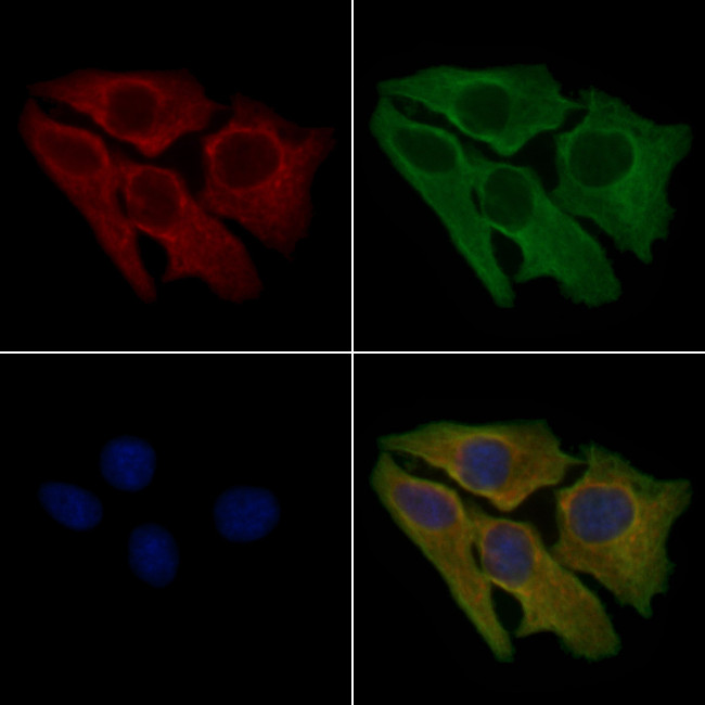 JIK Antibody in Immunocytochemistry (ICC/IF)