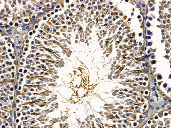 JIK Antibody in Immunohistochemistry (Paraffin) (IHC (P))