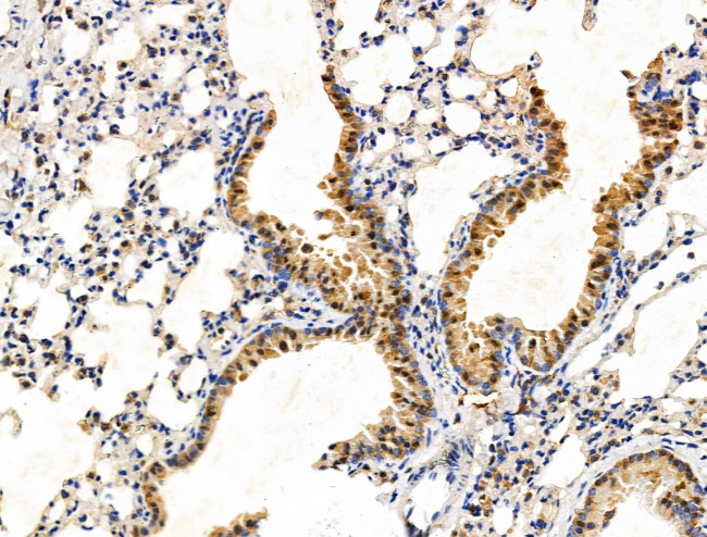 TBL1X Antibody in Immunohistochemistry (Paraffin) (IHC (P))