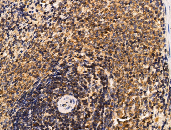 TBLR1 Antibody in Immunohistochemistry (Paraffin) (IHC (P))