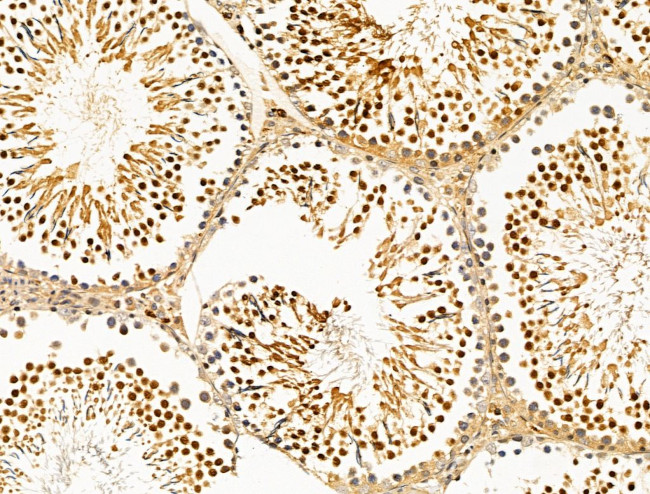 TBLR1 Antibody in Immunohistochemistry (Paraffin) (IHC (P))