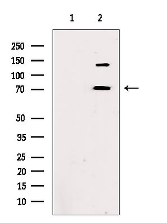 TBLR1 Antibody in Western Blot (WB)