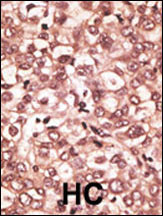 TLR6 Antibody in Immunohistochemistry (Paraffin) (IHC (P))