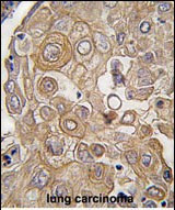 TLR6 Antibody in Immunohistochemistry (Paraffin) (IHC (P))