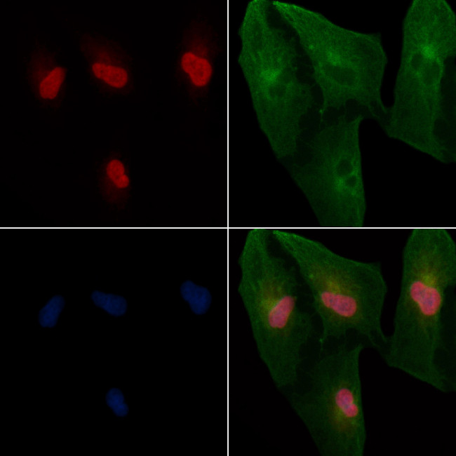 TBX2/3 Antibody in Immunocytochemistry (ICC/IF)