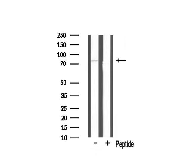 TBX2/3 Antibody in Western Blot (WB)