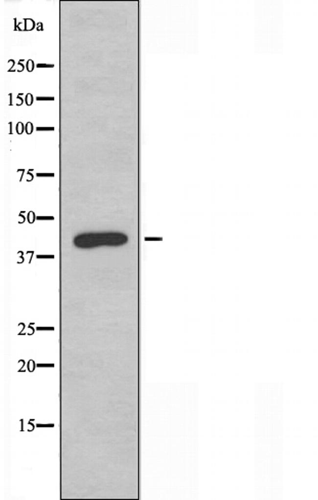 TBX10 Antibody in Western Blot (WB)