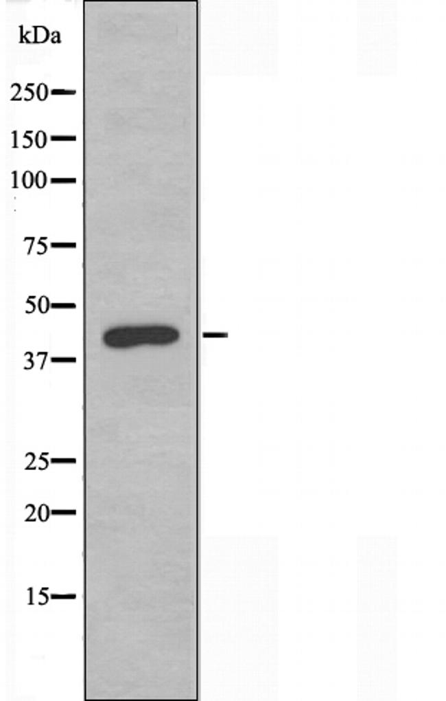 TCF7 Antibody in Western Blot (WB)