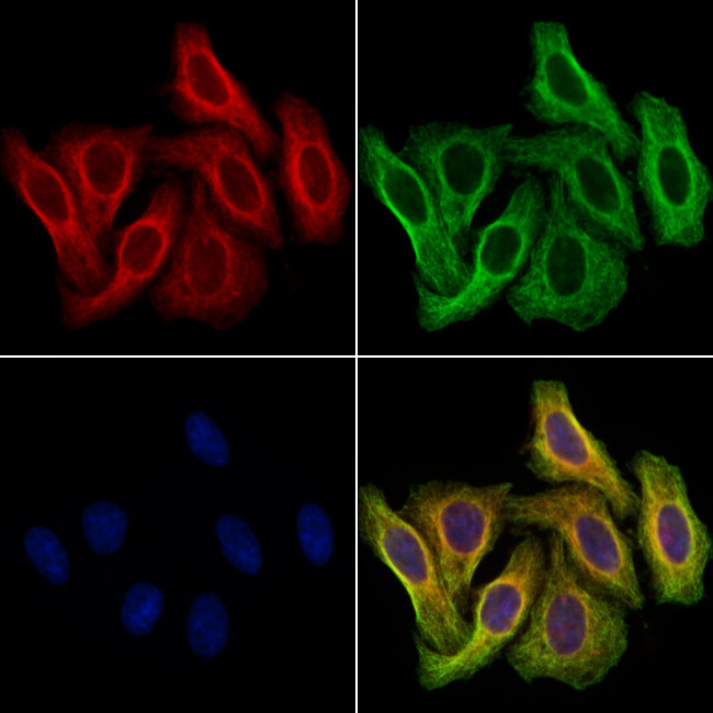 TCP-1 beta Antibody in Immunocytochemistry (ICC/IF)