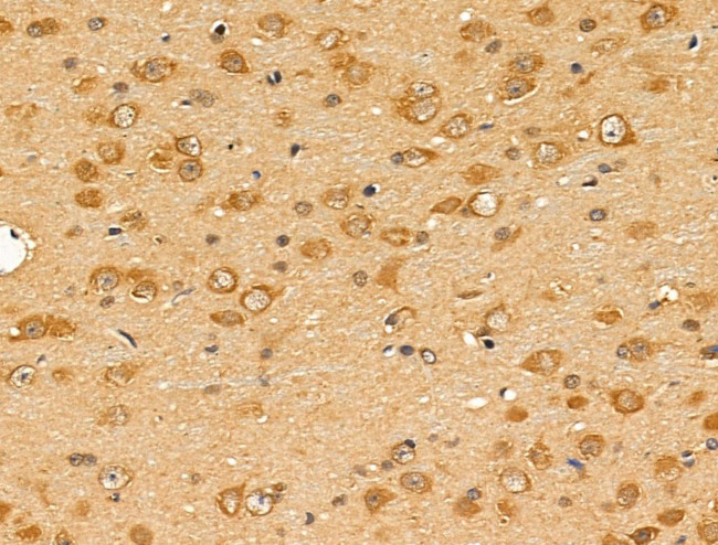 TCP-1 beta Antibody in Immunohistochemistry (Paraffin) (IHC (P))