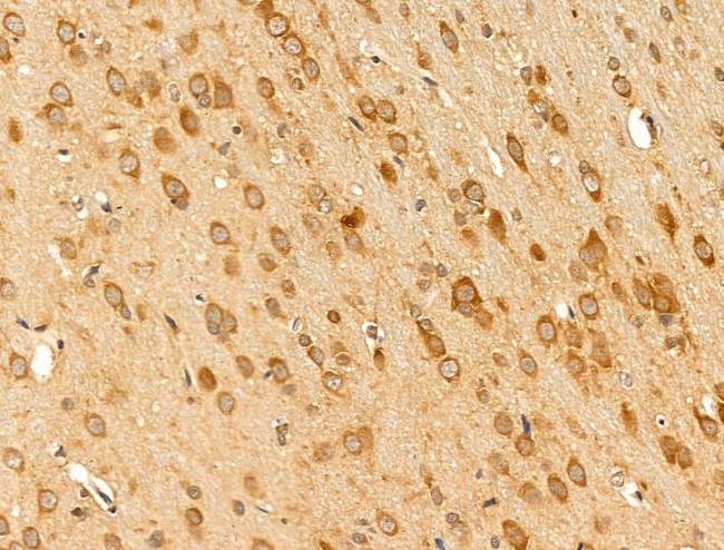 TCP-1 beta Antibody in Immunohistochemistry (Paraffin) (IHC (P))