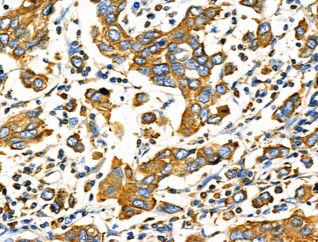 Cripto Antibody in Immunohistochemistry (Paraffin) (IHC (P))