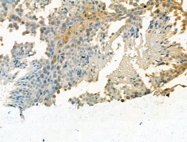 TDP1 Antibody in Immunohistochemistry (Paraffin) (IHC (P))