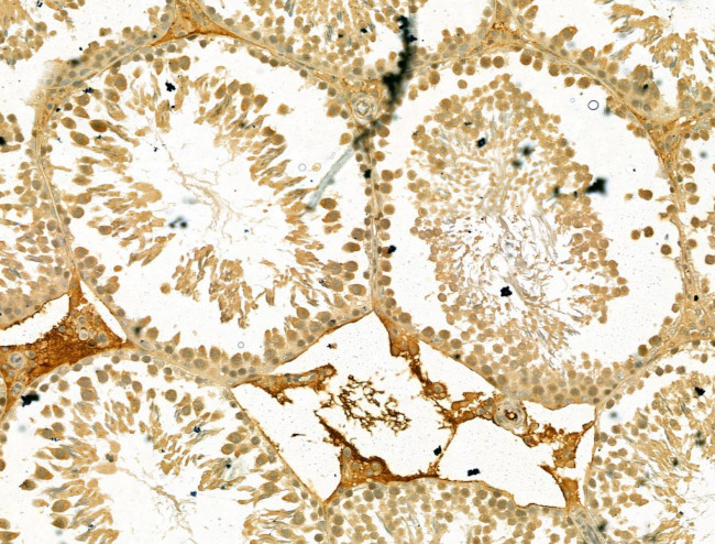 TDP1 Antibody in Immunohistochemistry (Paraffin) (IHC (P))