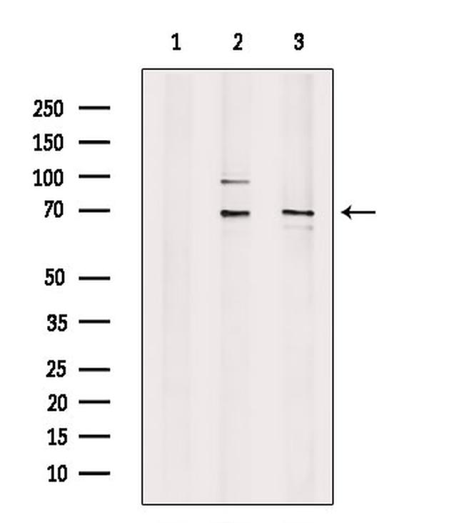 TDP1 Antibody in Western Blot (WB)