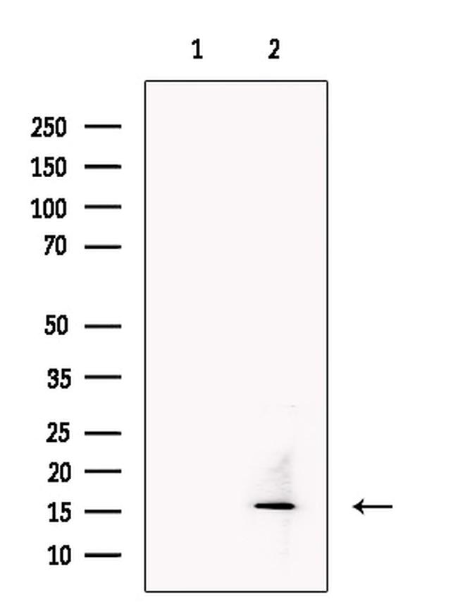 TECK Antibody in Western Blot (WB)