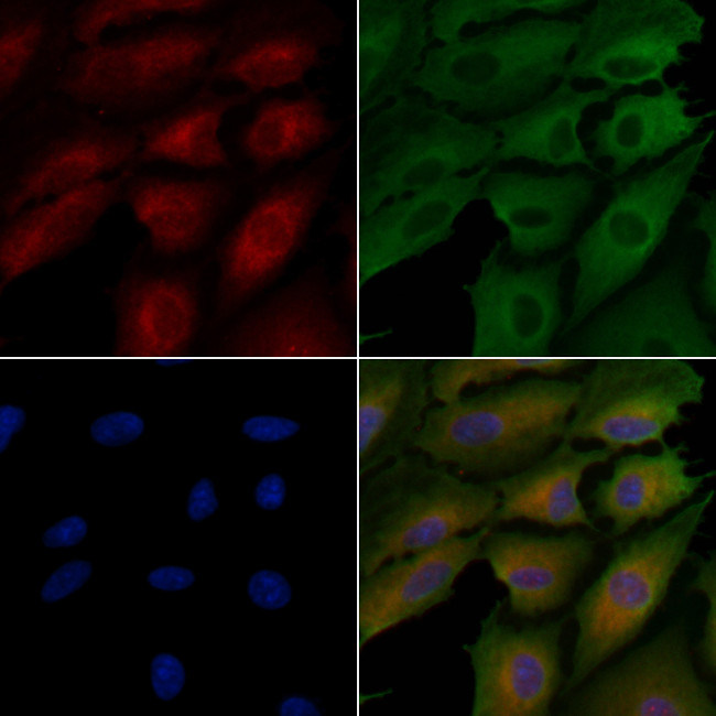 TNN Antibody in Immunocytochemistry (ICC/IF)