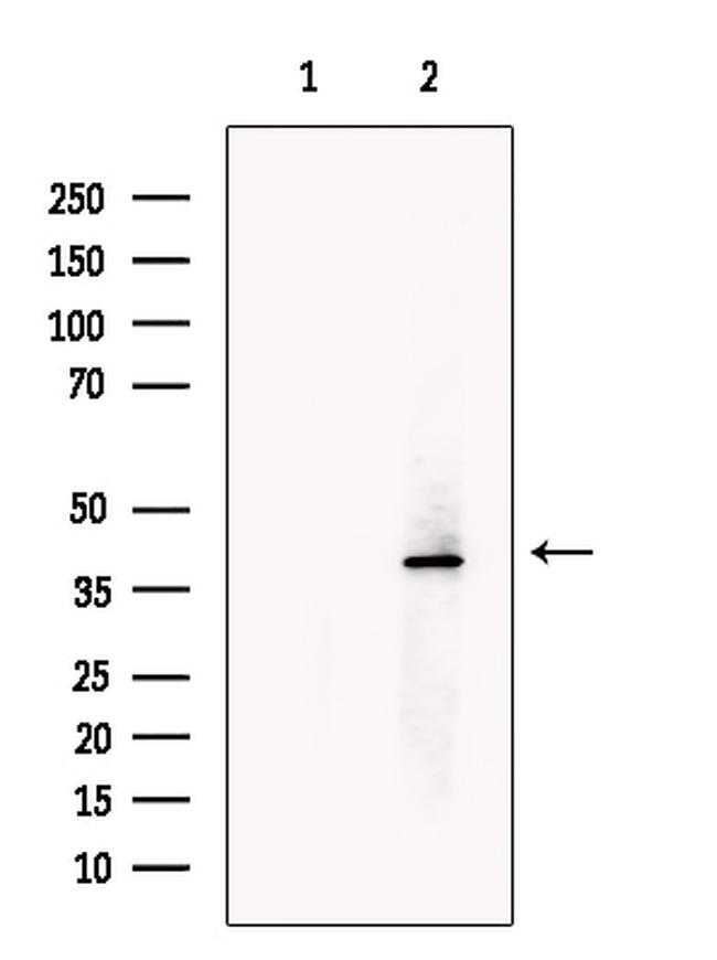 TNMD Antibody in Western Blot (WB)