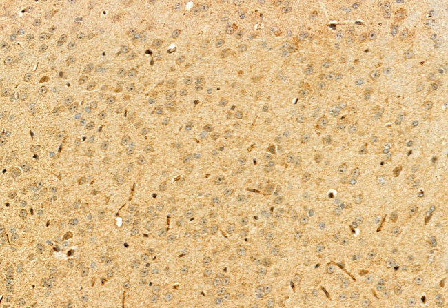 TERT Antibody in Immunohistochemistry (Paraffin) (IHC (P))