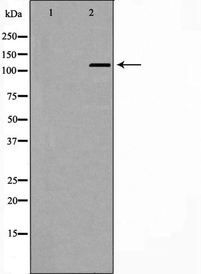 TERT Antibody in Western Blot (WB)