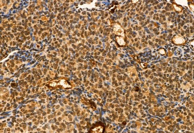 TET2 Antibody in Immunohistochemistry (Paraffin) (IHC (P))