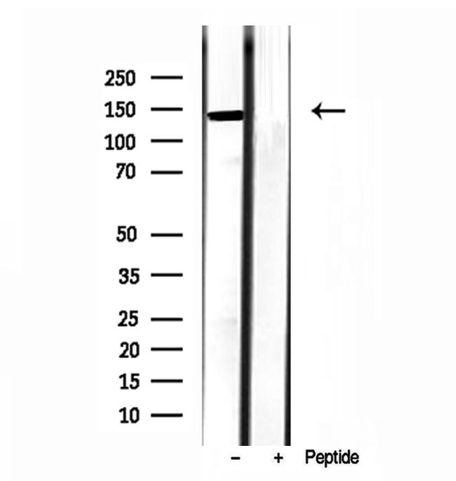 TET2 Antibody in Western Blot (WB)