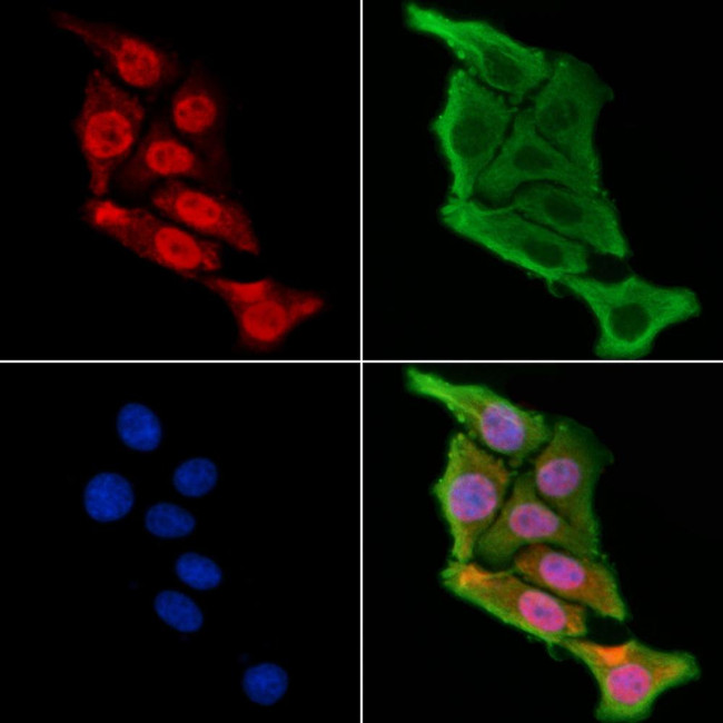 TFCP2L1 Antibody in Immunocytochemistry (ICC/IF)