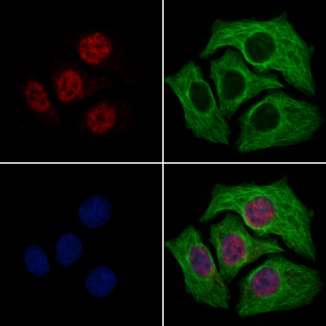 TFAP4 Antibody in Immunocytochemistry (ICC/IF)