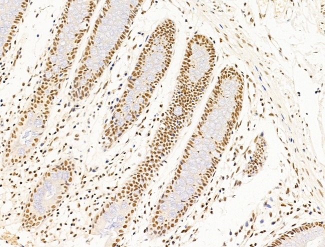 TFAP4 Antibody in Immunohistochemistry (Paraffin) (IHC (P))