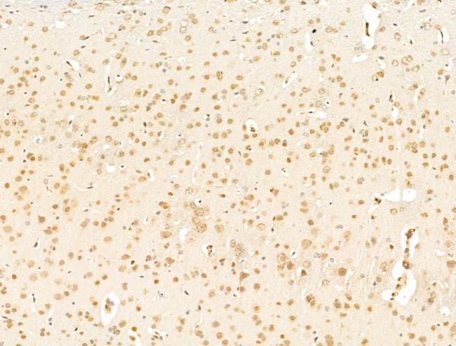 TFAP4 Antibody in Immunohistochemistry (Paraffin) (IHC (P))