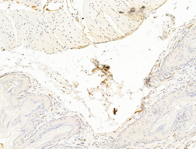 TFAP4 Antibody in Immunohistochemistry (Paraffin) (IHC (P))