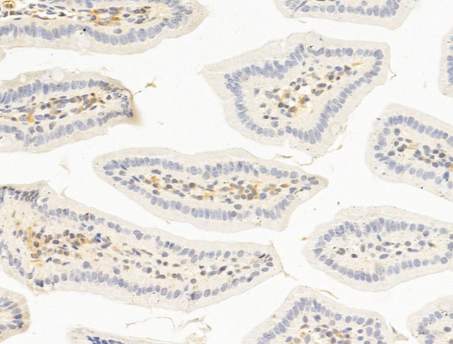 TFAP4 Antibody in Immunohistochemistry (Paraffin) (IHC (P))